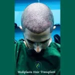 Mediplasta Hair Transplant & Aesthetic Clinic company logo